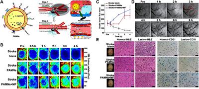 Application of stimuli-responsive nanomedicines for the treatment of ischemic stroke